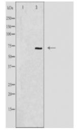 HIPK4 Antibody