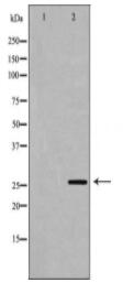 GSTA1 Antibody