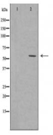 FGR Antibody