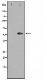 Cytochrome P450 20A1 Antibody