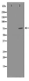 FOXP1 Antibody