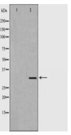 HAVCR2 Antibody