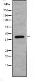 FOXD4/L2/L3/L4/L5/L6 Antibody