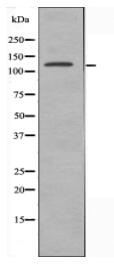EIF5B Antibody