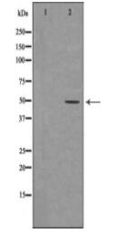 DDB2 Antibody