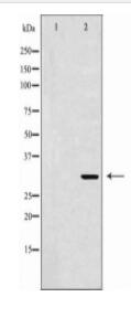 EEF1D Antibody