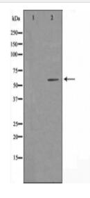 Cytochrome P450 4A11/22 Antibody