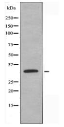 hnRNP C1/C2 Antibody