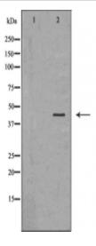 CYR61 Antibody