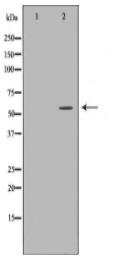 GALNS Antibody