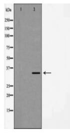FOSL2 Antibody