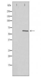 HEXB Antibody