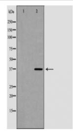 HNRNPA2B1 Antibody