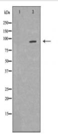 FES Antibody