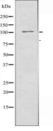 GRID2 Antibody