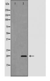 FAIM Antibody
