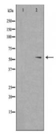 DUS2L Antibody