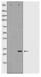 FXN Antibody