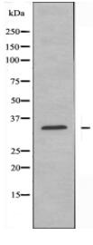FCGR2A Antibody