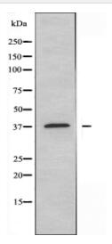 EIF3F Antibody