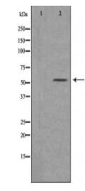 Cytochrome P450 21A2 Antibody