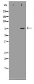 GARS Antibody