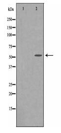 CPN1 Antibody