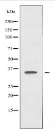 FAM84B Antibody