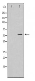 GABRG1 Antibody