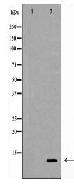 CSTA Antibody