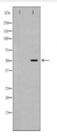 HCRTR2 Antibody