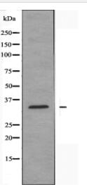 ELOVL1 Antibody