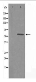 DAK Antibody