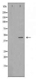 FCGR1A Antibody