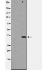 FCER2 Antibody