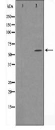 Cytochrome P450 24A1 Antibody