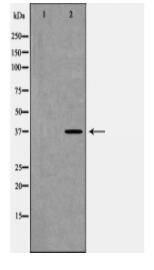 FAS Antibody