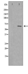 GPC3 Antibody