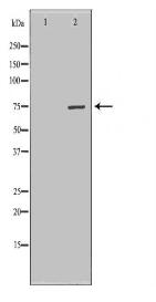 CPT2 Antibody