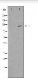 E2F8 Antibody