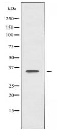 FOXN2 Antibody