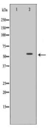 HNF1A Antibody