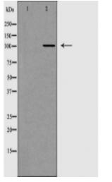 DDX58 Antibody