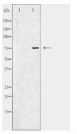 GLB1 Antibody