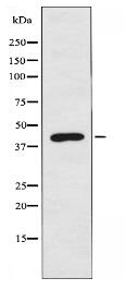 ACAT1 Antibody