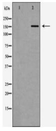 FANCD2 Antibody