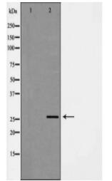 HDGF Antibody