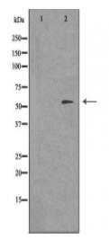 FRK Antibody