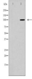 GRM8 Antibody