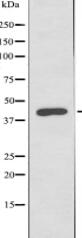 GPRC5D Antibody